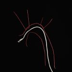 Aorta
