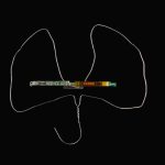 Thyroid
